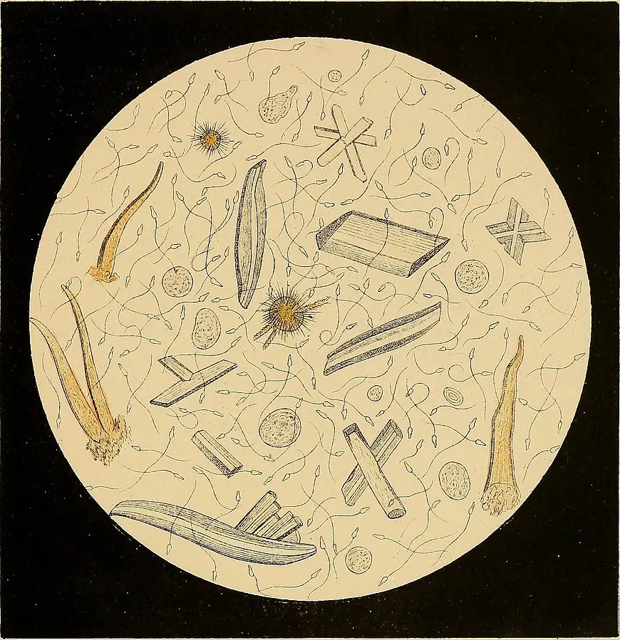 Week 2 – Clinical Microscopy